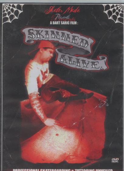 Skinned Alive