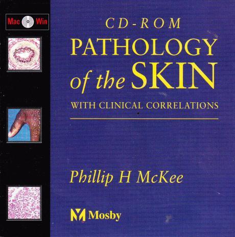 Pathology Of The Skill With Clinical Correlations