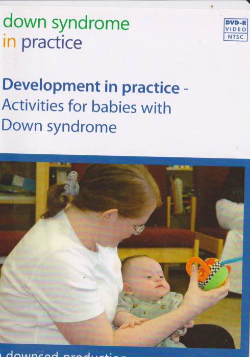Down Syndrome In Practice: Development In Practice