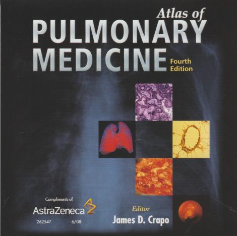 Atlas Of Pulmonary Medicine 4th